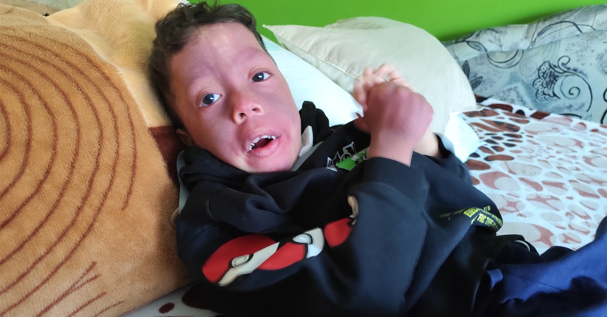 Ábel 3 hónapos korában agyvérzést kapott!