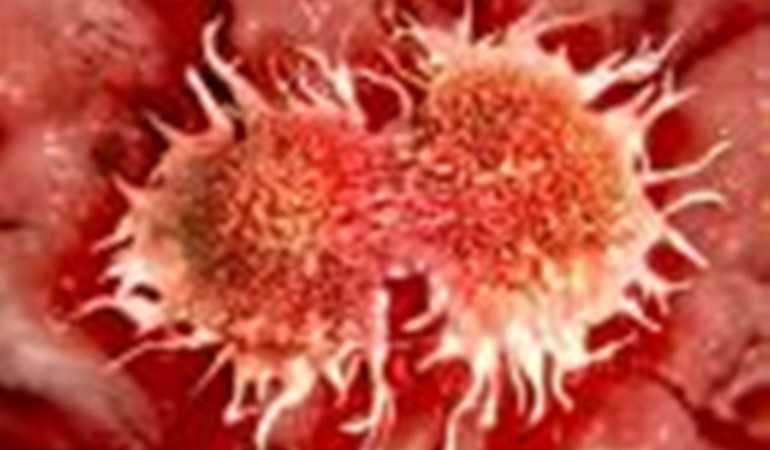 Hogyan képződnek az áttétek?