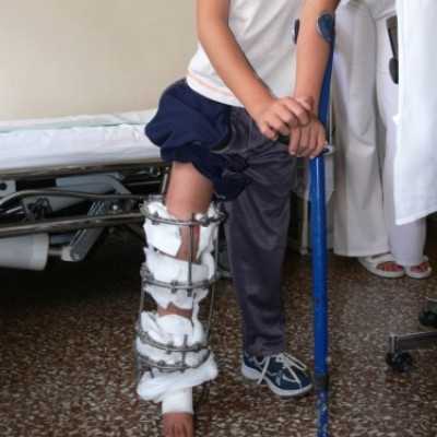 4,7 millió forintos Orthofix rendszer átadása a Semmelweis Egyetem Ortopédiai Klinikájának - adó, 1%, alapítvány, támogatás