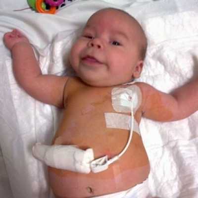 Célzott támogatás 2014. júliusban - alapítvány, adó 1%, támogatás