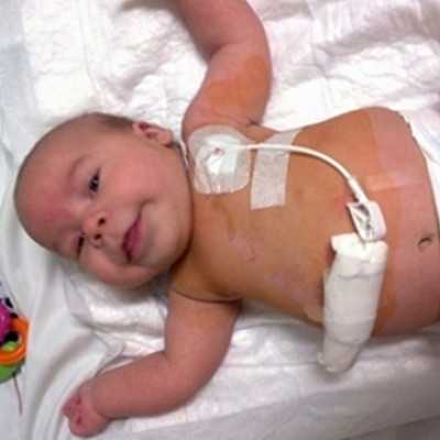 Célzott támogatás 2015. júliusban  - alapítvány, adó 1%, támogatás