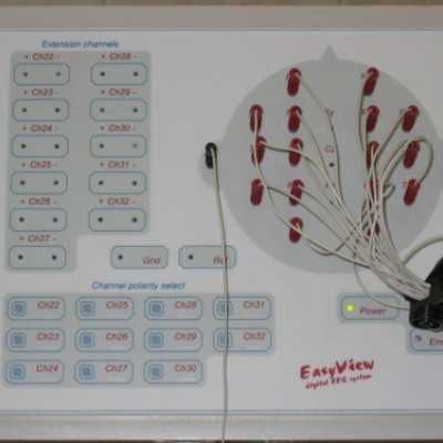 EEG készülék átadása a DE OEC Gyermekgyógyászati Intézetében - adó, 1%, alapítvány, támogatás