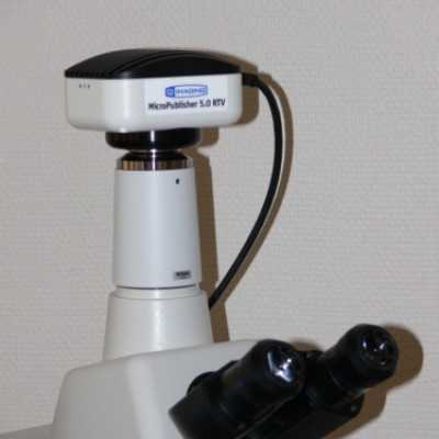 Mikroszkóp feltét átadása a Szt. István és Szt. László Kórházba - adó, 1%, alapítvány, támogatás