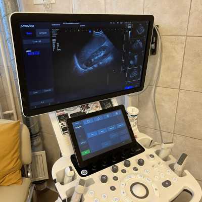 3 db Ultrahang vizsgálófej került átadásra a támogatóknak köszönhetően - alapítvány, adó 1%, támogatás