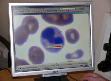 Mikroszkóp feltét átadása a Szt. István és Szt. László Kórházba