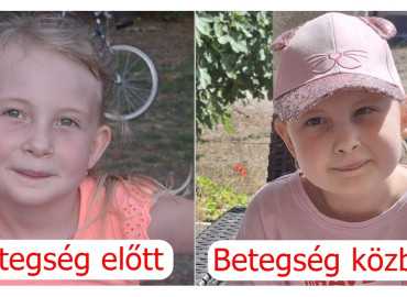 Együtt a ritka agydaganat ellen: Összefogás szükséges Hanna gyógykezeléséhez!