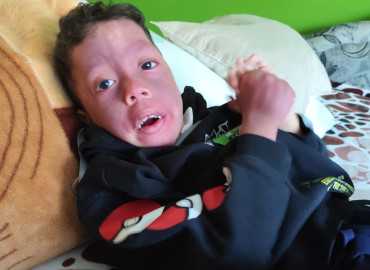 Ábel 3 hónapos korában agyvérzést kapott!